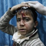 A wounded Palestinian child receives med