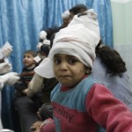 A wounded Palestinian child looks on at